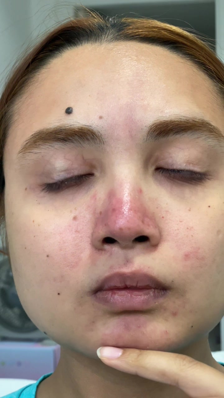 Radiant skin transformation reveal